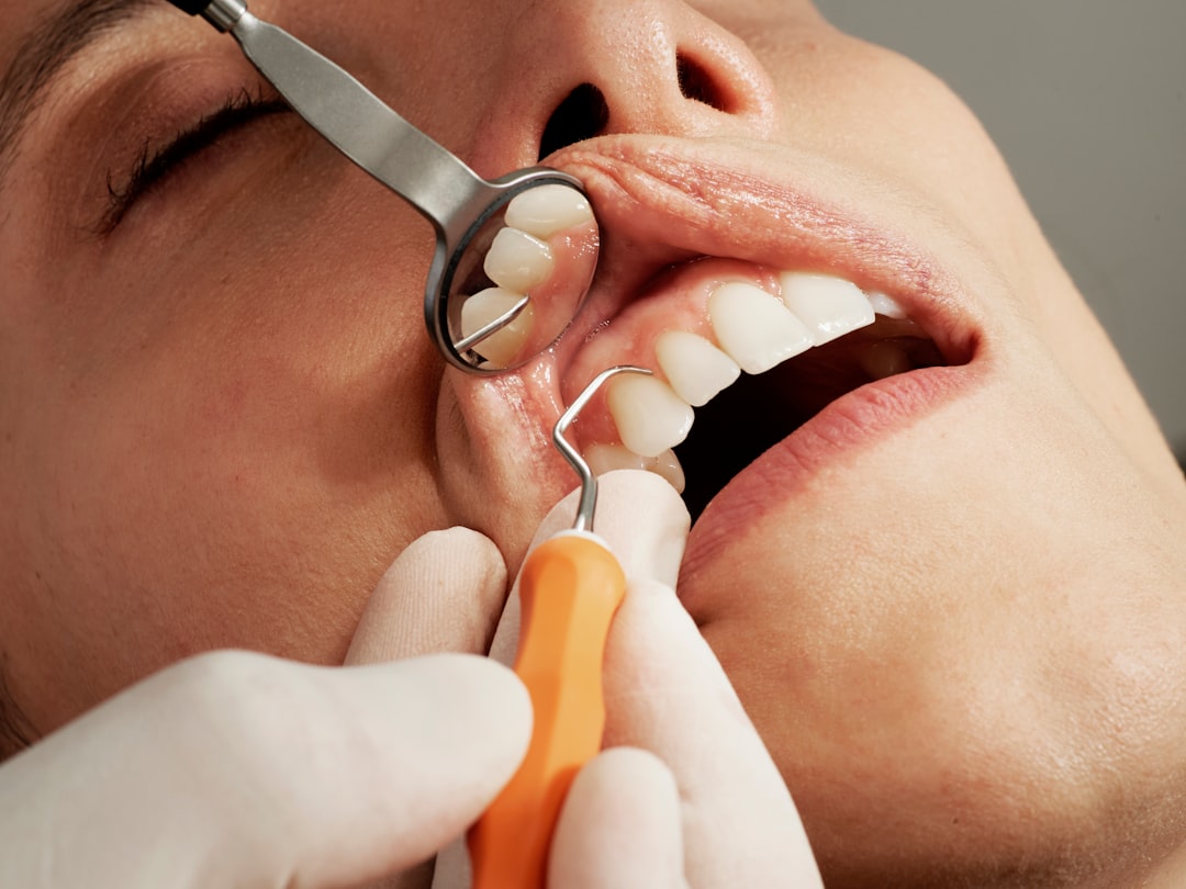 Endodoncia tratamiento de conducto