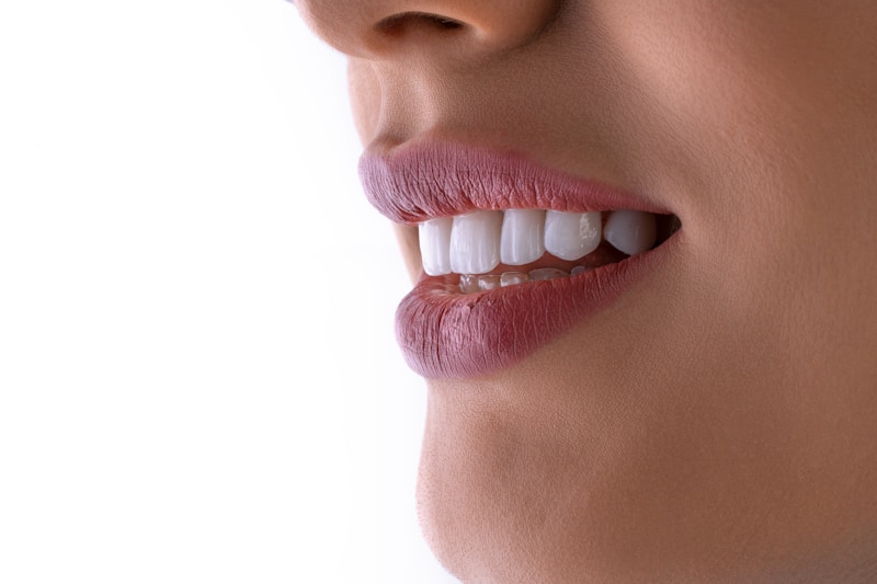 Diseño de sonrisa perfecta